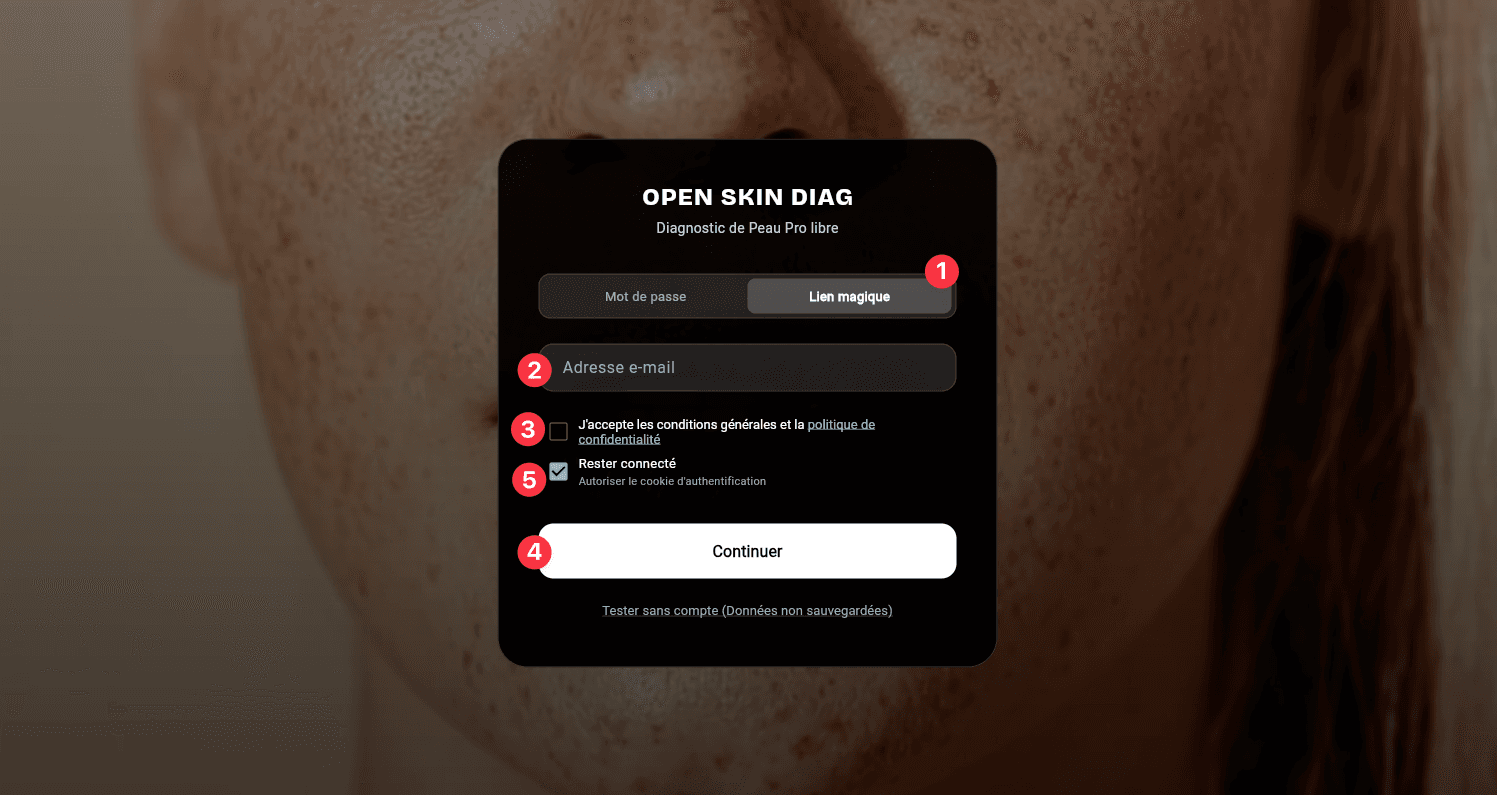 Écran de connexion OpenSkinDiag en mode lien magique : 1 onglet Lien magique, 2 adresse e-mail, 3 case d'acceptation des conditions générales, 5 Rester connecté, 4 bouton Continuer